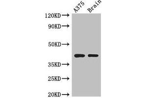Western Blot Positive WB detected in: A375 whole cell lysate, Mouse brain tissue All lanes: SEPT12 antibody at 3. (Septin 12 antibody  (AA 1-358))