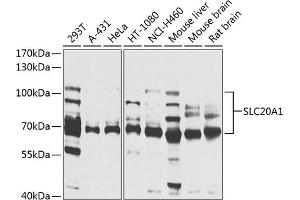 Western blot analysis of extracts of various cell lines, using SLC20 antibody (ABIN1682754, ABIN3018562, ABIN3018563 and ABIN6220499) at 1:1000 dilution. (SLC20A1 antibody  (AA 257-356))