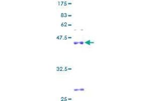 Image no. 1 for Shisa Homolog 5 (SHISA5) (AA 1-137) protein (GST tag) (ABIN1319949) (SHISA5 Protein (AA 1-137) (GST tag))