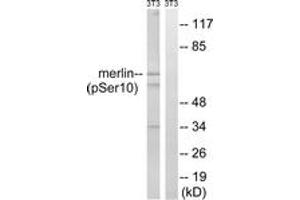 Western blot analysis of extracts from NIH-3T3 cells treated with IFN 2500U/ml 30', using Merlin (Phospho-Ser10) Antibody. (Merlin antibody  (pSer10))