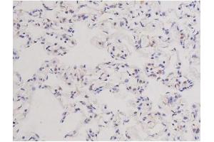 ABIN6266578 at 1/200 staining Rat lung tissue sections by IHC-P. (Ki-67 antibody  (Internal Region))