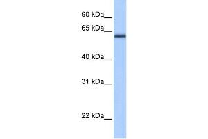 WB Suggested Anti-ZNF417 Antibody Titration:  0. (ZNF417 antibody  (N-Term))