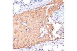 Immunohistochemistry (IHC) image for anti-Apolipoprotein A-I (APOA1) (AA 25-267) antibody (ABIN6136997)