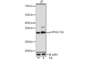 Western blot analysis of extracts of C6 cells, using Phospho-RP-T21 Rabbit mAb (ABIN7269916) at 1:1000 dilution. (RPA2 antibody  (pThr21))