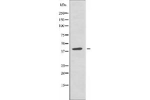 Western blot analysis of extracts from A549 cells, using TISD antibody. (ZFP36L2 antibody  (Internal Region))