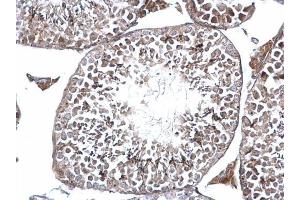 IHC-P Image DMC1 antibody [N1C1] detects DMC1 protein at nucleolus on mouse testis by immunohistochemical analysis. (DMC1 antibody  (Center))