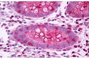 Anti-CEA antibody IHC staining of human colon. (CEACAM5 antibody)