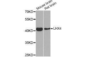 Western blot analysis of extracts of various cell lines, using LHX4 Antibody (ABIN5975324) at 1/1000 dilution. (LHX4 antibody)