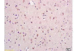 Formalin-fixed and paraffin embedded mouse kidney tissue labeled with Anti PRODH Polyclonal Antibody,Unconjugated (ABIN715136) at 1:200 followed by conjugation to the secondary antibody and DAB staining. (PRODH antibody  (AA 141-240))