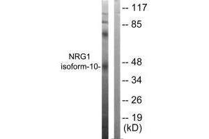 Western blot analysis of extracts from SKOV3 cells, using NRG1 isoform-10 antibody. (Neuregulin 1 antibody  (Isoform 10))