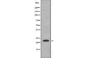 Western blot analysis of extracts from HepG2 cells, using TNFC antibody. (LTB antibody  (C-Term))
