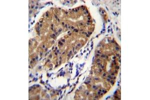 Formalin fixed and paraffin embedded human stomach tissue stained with Netrin receptor DCC  Antibody  followed by peroxidase conjugation of the secondary antibody and DAB staining.