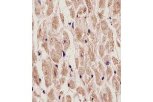 (ABIN6242180 and ABIN6577907) staining ADORA2A in Human heart tissue sections by Immunohistochemistry (IHC-P - paraformaldehyde-fixed, paraffin-embedded sections). (Adenosine A2a Receptor antibody  (C-Term))