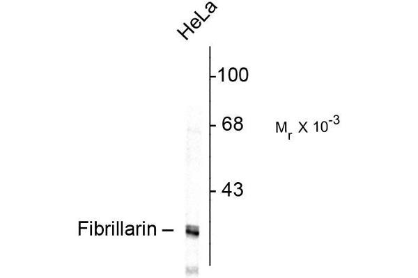 Fibrillarin Antikörper