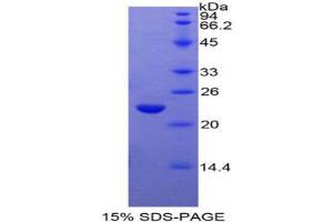 SDS-PAGE analysis of Rat GaA Protein.