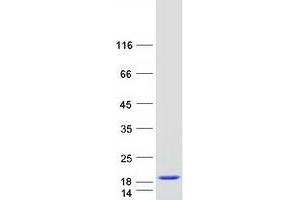 Western Blotting (WB) image for Myosin Light Chain 6, Alkali, Smooth Muscle and Non Muscle (MYL6) (Transcript Variant 1) protein (Myc-DYKDDDDK Tag) (ABIN2726672)