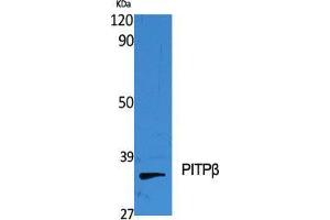 Western Blot (WB) analysis of specific cells using PITPbeta Polyclonal Antibody.