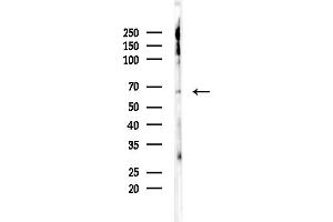 Western blot analysis of lysates from Mouse brain, using RIOK1 Antibody at 1/1000 dilution.