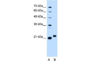 WB Suggested Anti-C1orf159 Antibody Titration:  0.