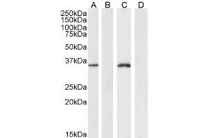 Western Blotting (WB) image for anti-Forkhead Box L2 (FOXL2) (C-Term) antibody (ABIN185040)