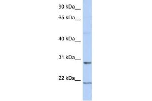 WB Suggested Anti-C12orf53 Antibody Titration: 0. (C12orf53 antibody  (Middle Region))