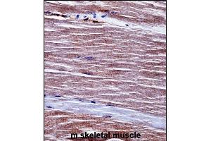 Mouse Acvr1 Antibody (Center) ((ABIN657718 and ABIN2846706))immunohistochemistry analysis in formalin fixed and paraffin embedded mouse skeletal muscle followed by peroxidase conjugation of the secondary antibody and DAB staining. (ACVR1 antibody  (AA 137-166))