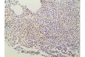 Immunohistochemistry (IHC) image for anti-Ephrin B2 (EFNB2) (C-Term) antibody (ABIN6261455)