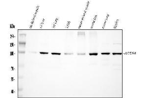 Western blot analysis of Alpha Actinin 4 using anti-Alpha Actinin 4 antibody (ABIN4886421).