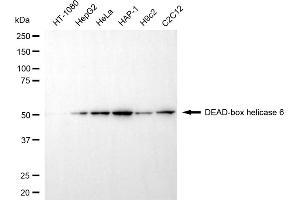 Western blotting analysis using DEAD-box helicase 6 antibody (ABIN7798291).
