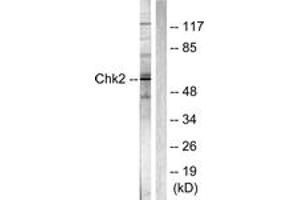 Western Blotting (WB) image for anti-Checkpoint Kinase 2 (CHEK2) (AA 361-410) antibody (ABIN2888620) (CHEK2 antibody  (AA 361-410))