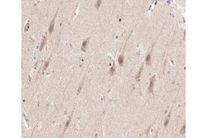 ABIN6266540 at 1/100 staining human brain tissue sections by IHC-P. (FGFR3 antibody  (C-Term))