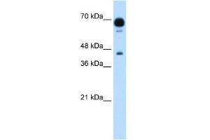 WB Suggested Anti-PUS7 Antibody Titration:  1. (PUS7 antibody  (N-Term))