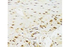 Immunohistochemistry (Paraffin-embedded Sections) (IHC (p)) image for anti-Elongation Factor Tu GTP Binding Domain Containing 2 (EFTUD2) antibody (ABIN7262991)