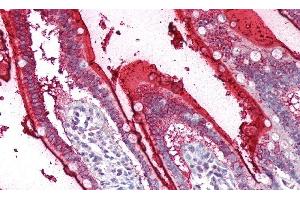 Detection of SI in Human Small Intestine Tissue using Polyclonal Antibody to Sucrase Isomaltase (SI) (Sucrase Isomaltase antibody  (AA 1717-1827))