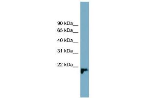 WB Suggested Anti-C1orf93 Antibody Titration: 0. (C1orf93 antibody  (Middle Region))