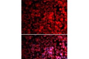 Immunofluorescence analysis of MCF7 cells using RPS10 Polyclonal Antibody (RPS10 antibody)