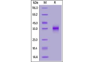 Biotinylated SARS-CoV-2 Spike RBD (L452R), His,Avitag on  under reducing (R) condition.
