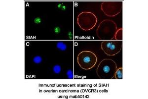 Image no. 1 for anti-Siah E3 Ubiquitin Protein Ligase 2 (SIAH2) (AA 1-100), (N-Term) antibody (ABIN363296) (SIAH2 antibody  (N-Term))