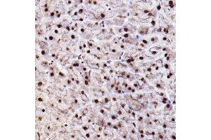 Immunohistochemistry of paraffin-embedded mouse pancreas using Phospho--S473+-S474+-S472 Rabbit pAb (ABIN7265523) at dilution of 1:100 (40x lens). (AKT 1/2/3 antibody  (pSer472))