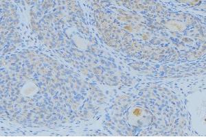 ABIN6268899 at 1/100 staining Human uterus tissue by IHC-P. (Gastrin antibody  (C-Term))