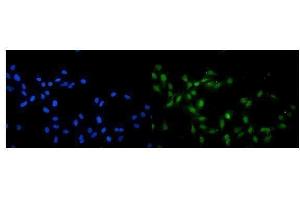 IF analysis of KAT13A/SRC1 using anti-KAT13A/SRC1 antibody (ABIN3042385). (NCOA1 antibody  (AA 614-826))