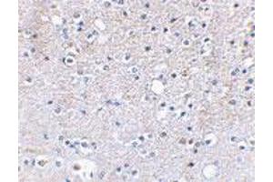 Immunohistochemical staining of human brain tissue using GRIK5 polyclonal antibody  at 2. (GRIK5 antibody  (C-Term))