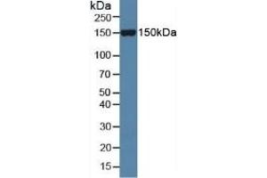 Detection of Slit1 in Mouse Serum using Polyclonal Antibody to Slit Homolog 1 (Slit1) (SLIT1 antibody  (AA 603-773))