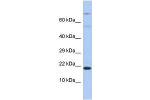 Host: Rabbit Target Name: HN1 Sample Type: Fetal Stomach lysates Antibody Dilution: 1. (HN1 antibody  (C-Term))