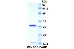 SDS-PAGE (SDS) image for Antigen Identified By Monoclonal Antibody Ki-67 (MKI67) (AA 2815-2928) protein (His tag) (ABIN1080171) (Ki-67 Protein (AA 2815-2928) (His tag))
