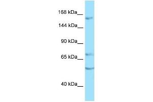 WB Suggested Anti-PTPRT Antibody Titration: 1. (PTPRT antibody  (C-Term))