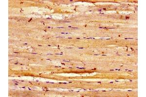 Immunohistochemistry of paraffin-embedded human skeletal muscle tissue using ABIN7150914 at dilution of 1:100 (Dysferlin antibody  (AA 105-278))