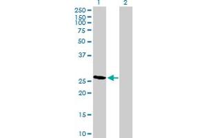 Western Blot analysis of RCAN2 expression in transfected 293T cell line by RCAN2 MaxPab polyclonal antibody.