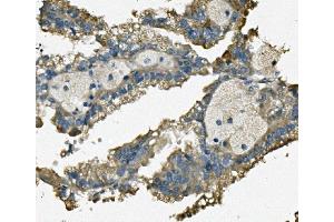 IHC analysis of FIS1 using anti-FIS1 antibody (ABIN7598965).