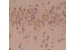 Used in DAB staining on fromalin fixed paraffin- embedded Kidney tissue (CD160 antibody  (AA 33-171))